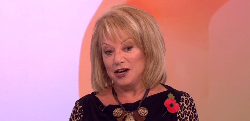 elaine paige plastic surgery