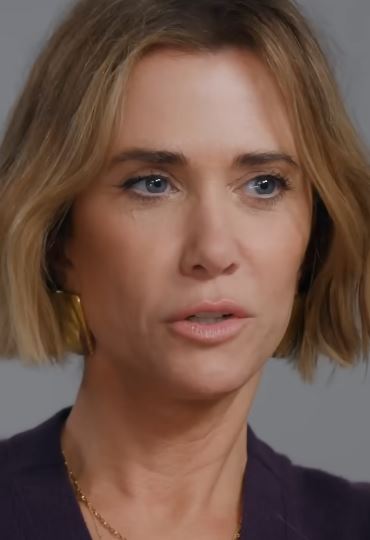 kristen wiig plastic surgery