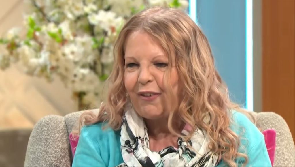 sally thomsett face illness sally thomsett face illness