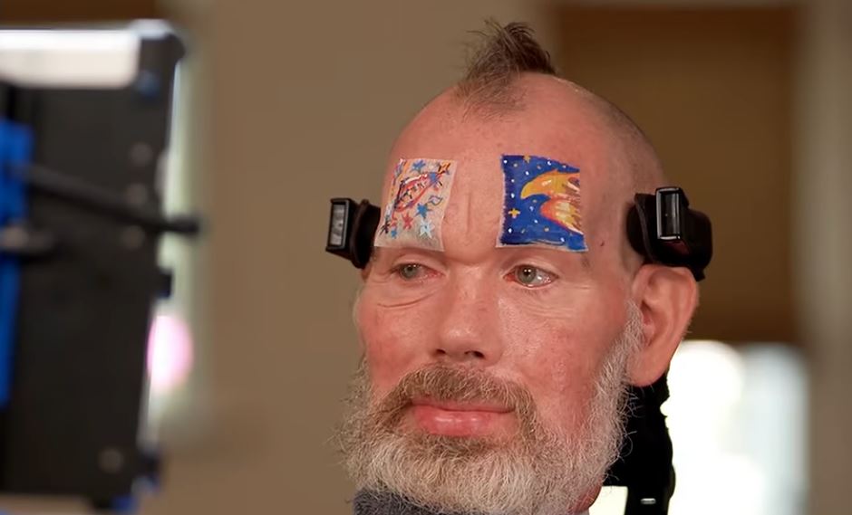 Steve Gleason Credit Good Morning America